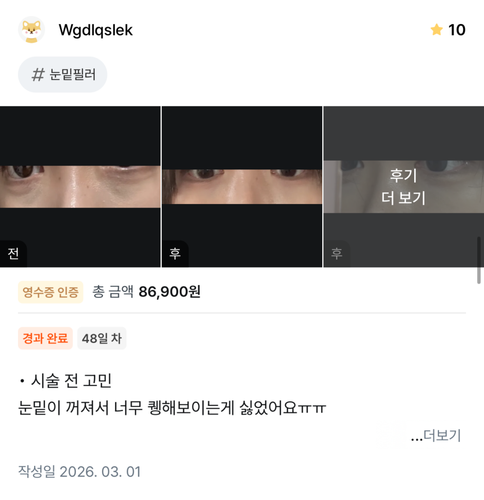 KakaoTalk 20260404 132421293 08 - 디온의원 선릉점