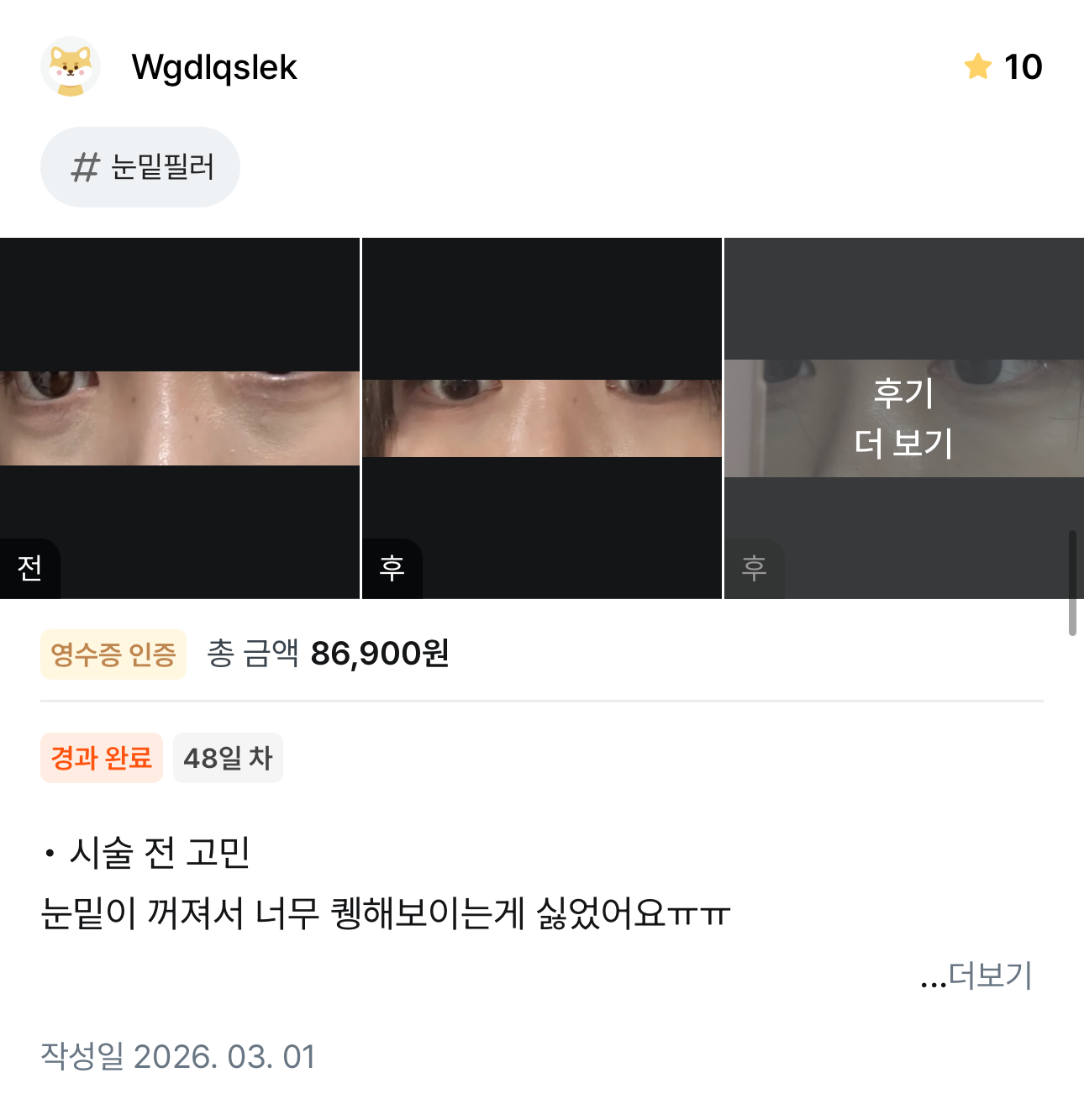 KakaoTalk 20260404 132421293 08 - 디온의원 선릉점
