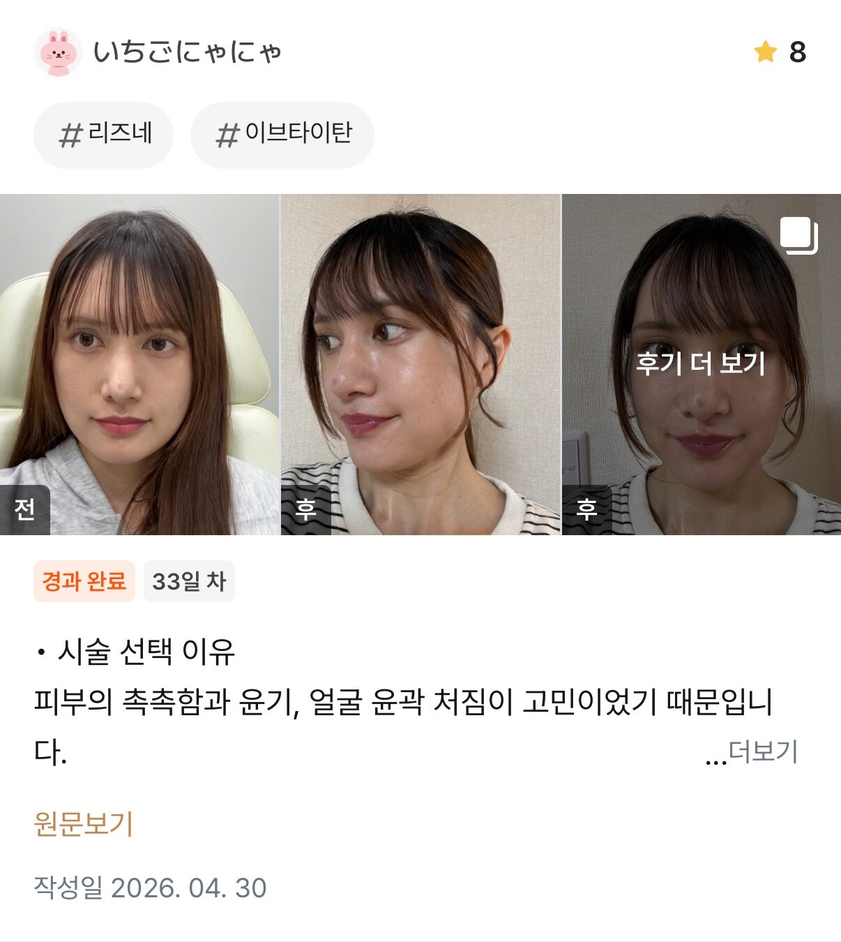 KakaoTalk 20260601 104111611 e1780981758460 - 디온의원 선릉점