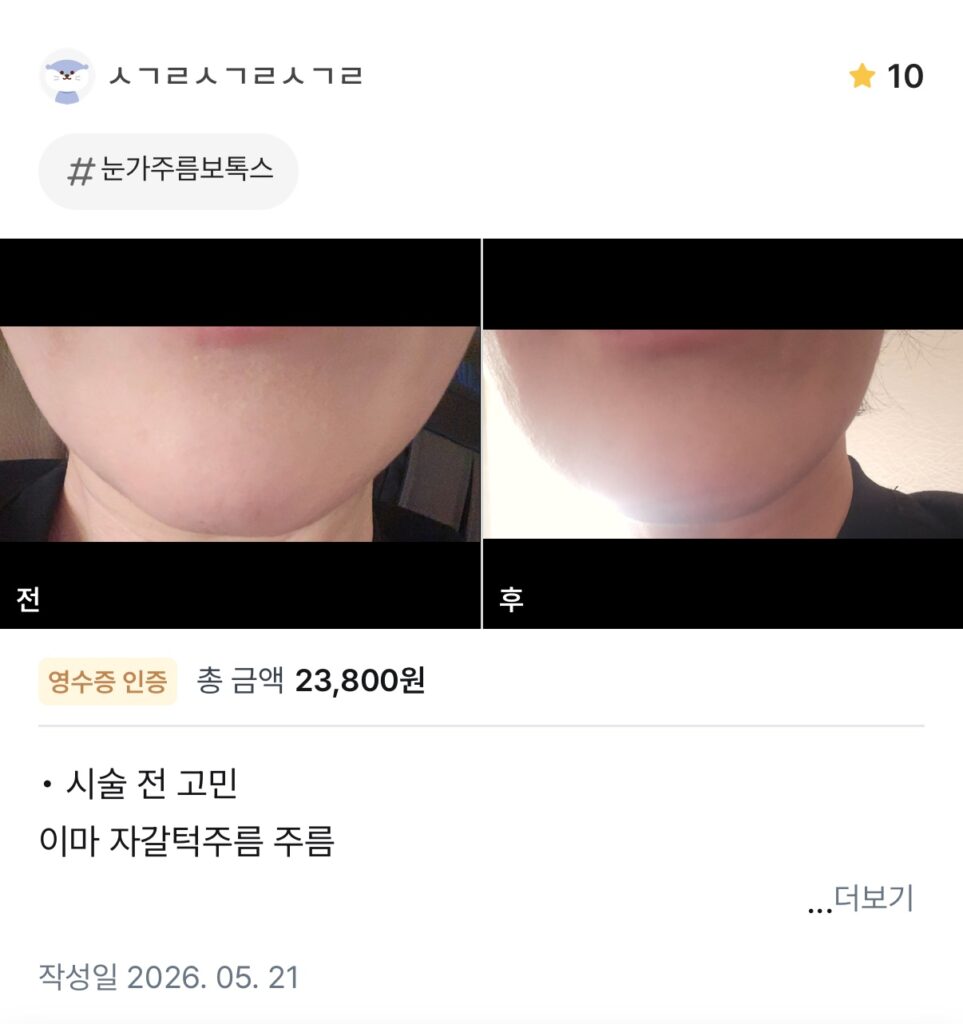 KakaoTalk 20260601 104111611 02 e1780981705484 - 디온의원 선릉점