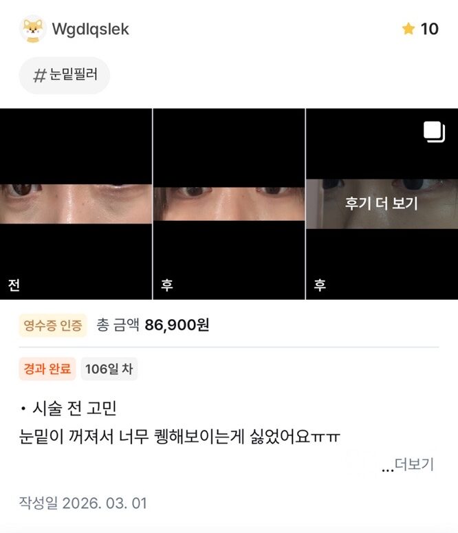 KakaoTalk 20260601 105122013 e1780981677502 - 디온의원 선릉점