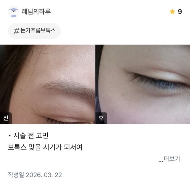 KakaoTalk 20260601 105122013 05 e1780981527927 - 디온의원 선릉점
