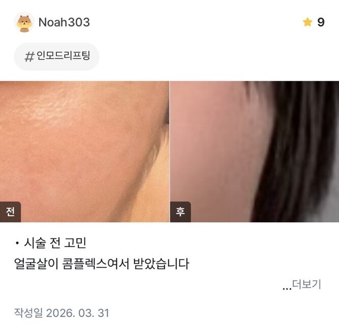 KakaoTalk 20260601 105122013 06 e1780981484108 - 디온의원 선릉점