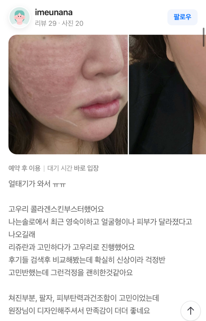 KakaoTalk 20260601 115605147 04 e1780981270762 - 디온의원 선릉점